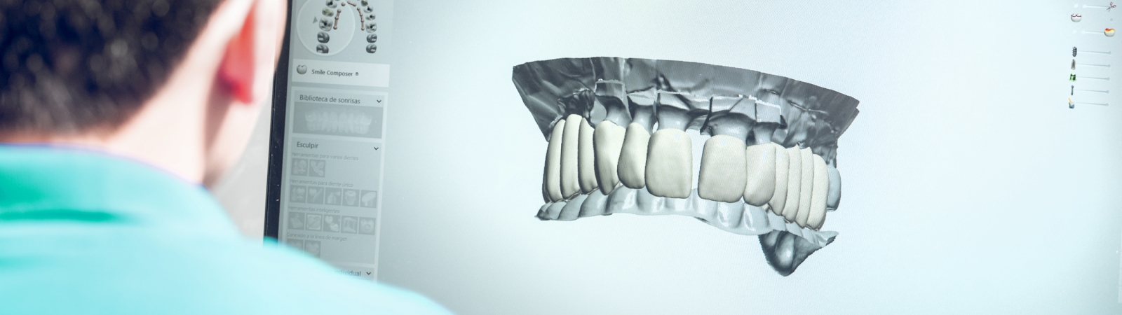 examining model of jaw implant